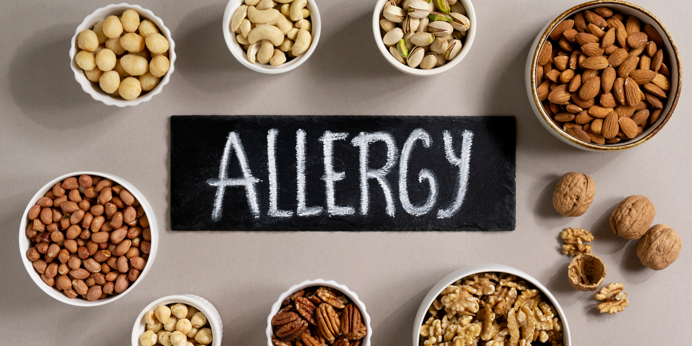 14 allergén lista részletesen – mit kell tudnod róluk?